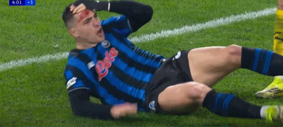 1772062845235056273.gif bob官方网站-【欧冠】爆笑逆转!多特倒霉蛋独送4球救活亚特兰大